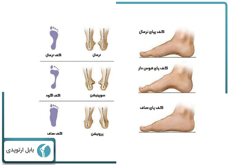 بابل ارتوپدی