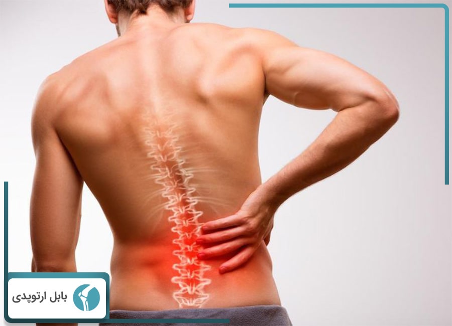 مشکلات ستون فقرات